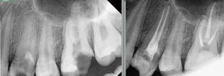 Case Spotlight